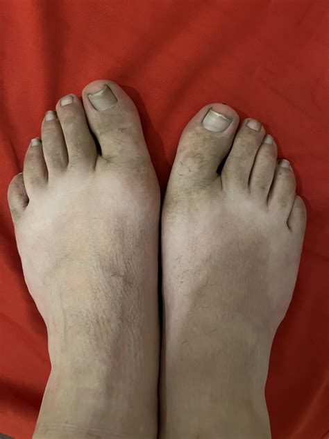 phub feet|Just a little pic of my dirty feet after a day at work.